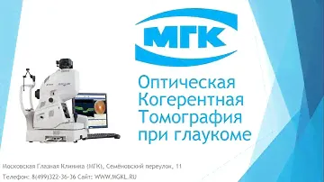 ОКТ при глаукоме (оптическая когерентная томография диска зрительного нерва)